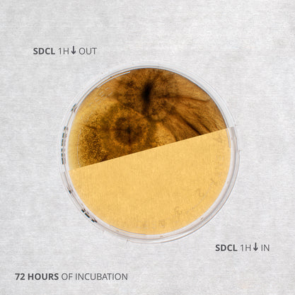 Contact tests inside and outside a laminar flow hood using Sabouraud Dextrose agar plates