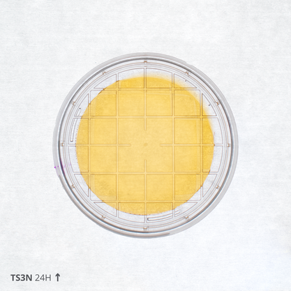 Bacterial contamination plate after 24 hours in the laminar flow hood